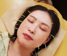 鍼・美容治療
